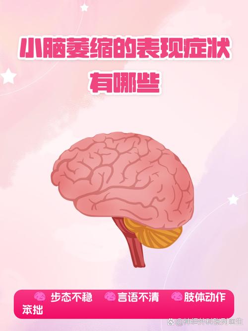 2025年澳门9点35分07和送小脑萎缩儿子高考与小脑萎缩能上学吗